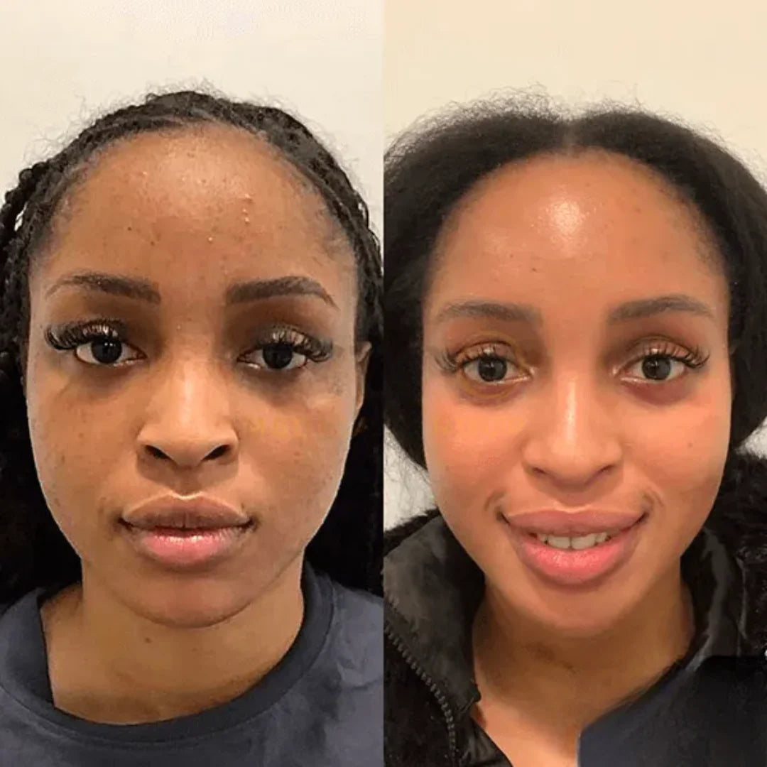 Instantly transform your